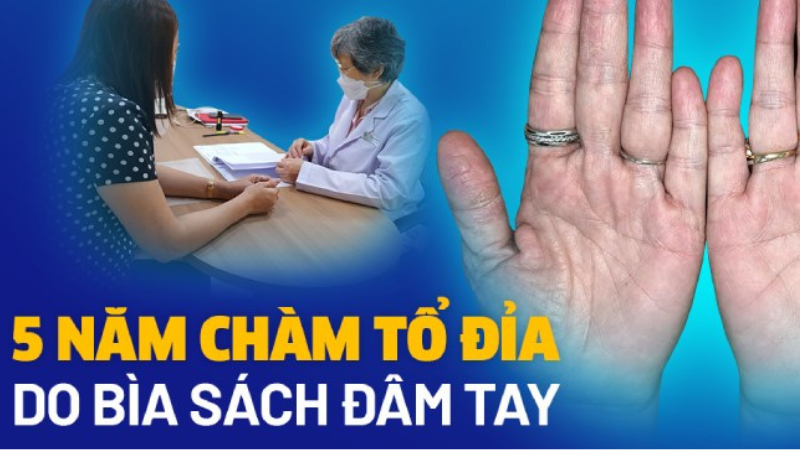 bệnh tổ đỉa có chữa được không